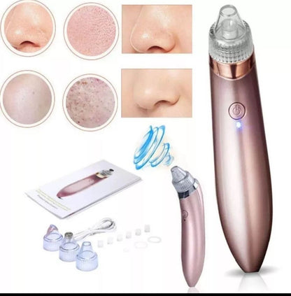 EXTRACTOR DE PUNTOS NEGROS