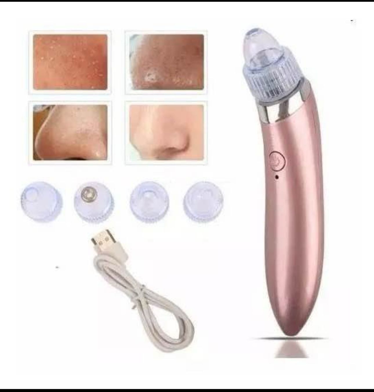 EXTRACTOR DE PUNTOS NEGROS